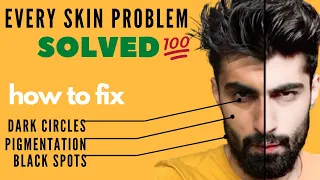 Ye Skin Care Routine Kardega Saari Skin Problems SOLVED | Pigmentation Pimple Dark | Mridul Madhok