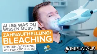 Bleaching / Zahnaufhellung - Alle Fakten : Ablauf, Kosten, Haltbarkeit, Risiken + Vorher-Nachher