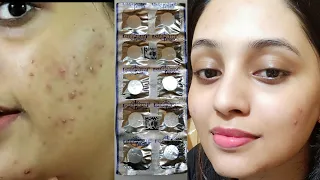 most effective acne face mask || Treatment of acne with DISPRIN || How to use DISPRIN as skincare ||