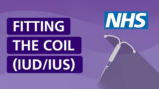 Fitting the coil (IUD/IUS) | NHS