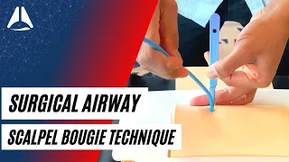 Scalpel bougie technique in CICO emergencies | Airway Management
