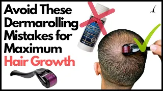 5 Dermarolling MISTAKES to AVOID for Hair Growth!