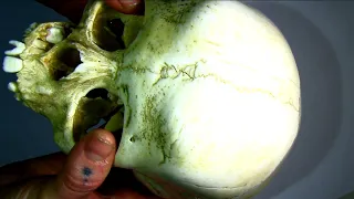 Skull features part 1