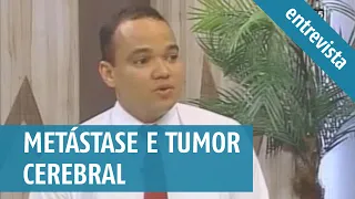 Quais os sintomas de metástase no cérebro? Quanto tempo vive uma pessoa com metástase no cerebral?