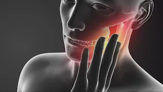 Consumer Reports: Is stress causing you to grind your teeth?