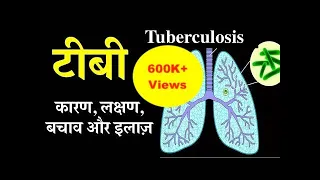 Tuberculosis causes, symptoms, treatment & prevention in Hindi | टीबी के कारण, लक्षण, बचाव और इलाज़