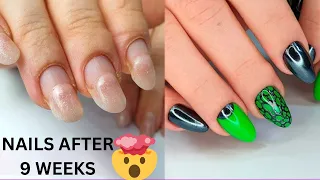 9 WEEK OLD NAILS 😱 Repairing Cracked Nails W/ COTTON
