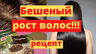 Чудо Средство Усилит Рост Волос И Остановит Выпадение! Знаменитый Рецепт