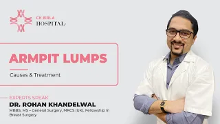 Causes and Treatment of Armpit Lumps (In Hindi) by Dr. Rohan Khandelwal | CK Birla Hospital