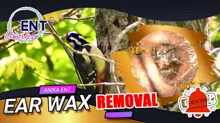 AnikaENT | Alternative earwax removal treatments [Ep#122]