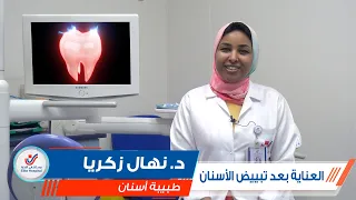 العناية بعد تبييض الأسنان || د. نهال زكريا