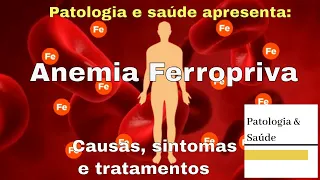 Anemia Ferropriva: Causas, sintomas e tratamentos.