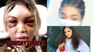 BOBRISKY SURGICAL PROCEDURE TO REMOVE HIS DICK . FULL VIDEO