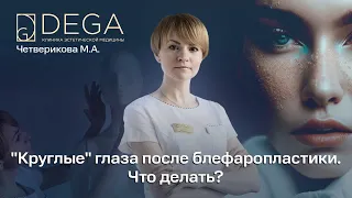 Круглые" глаза после блефаропластики. Что делать?