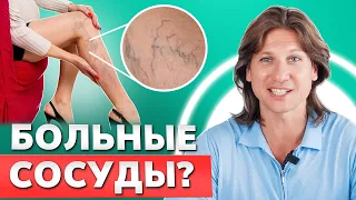 УБИРАЕМ варикоз и возвращаем КРАСОТУ своих НОГ!