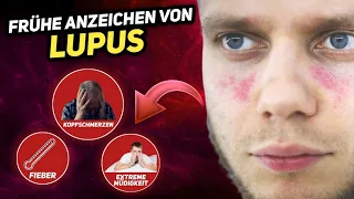 10 Frühe Anzeichen von Lupus, die du nicht ignorieren solltest