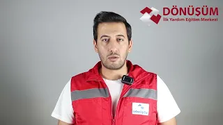 3. Derece Yanık