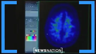 Researchers develop vaccine to fight brain cancer | Morning in America