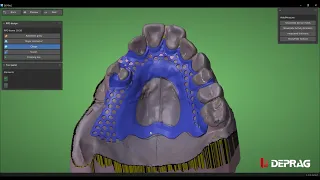 AICAD_Maxillary double clamp