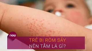 Trẻ bị rôm sảy nên tắm lá gì? | VTC Now