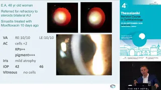 P. Tranos | Dealing with the complications of uveitis