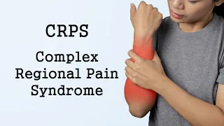 Complex Regional Pain Syndrome (CRPS)