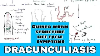 Dracunculiasis | Guinea worm | Structure, Life cycle, symptoms, treatment | Bio science