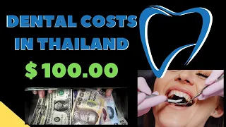 DENTAL COSTS IN THAILAND V660