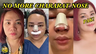 MY RHINOPLASTY JOURNEY (FULL VIDEO)