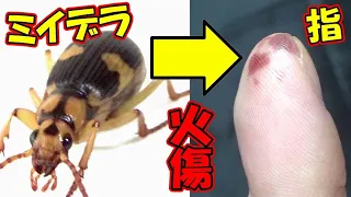 【灼熱のガスで大火傷？】ミイデラゴミムシの屁を浴びてみた結果！