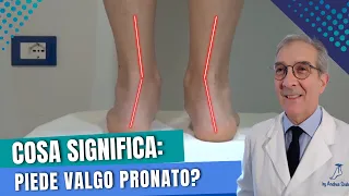 Piede pronato valgo: Il "FALSO PIEDE PIATTO" | Come riconoscere il piede valgo pronato