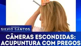 Acupuntura com Pregos | Câmeras Escondidas (07/01/18)