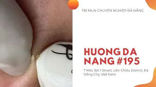 #195 | Huong Da Nang