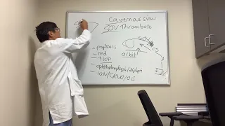 Cavernous Sinus and Superior Ophthalmic Vein Thrombosis