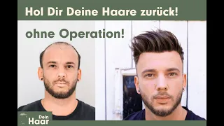 Dein Haar - Hol es Dir zurück - Volles Haar, ohne Operation. Das Haarsystem für zuhause.