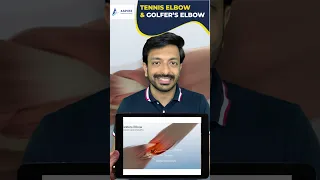 TENNIS ELBOW & GOLFER’S ELBOW EXPLAINED | Aspire Education | PLAB2