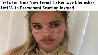 r/FacePalms | TikTok Perfect Skin Trend Ruining Skin Instead