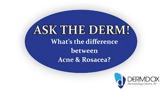 Ask the Derm - What's the difference between Acne and Rosacea? - DermDox Dermatology Centers