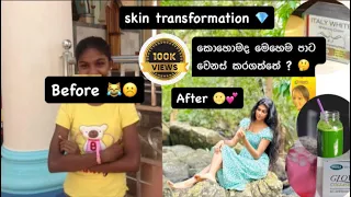 මෙහෙම පාට වෙනස් කරගත්තේ කොහොමද? 🙀😹💕| my skin transformation💎|#viral #vlogger #beauty