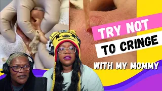 Try Not To Cringe | Pimple Popping | Next LvL | AyChristene Reacts