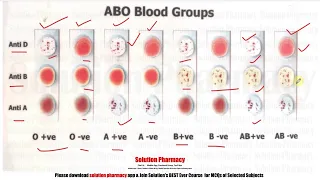 Blood Group Test =  Determination of Blood Group | All Blood Group | Testing Blood Group | ENGLISH