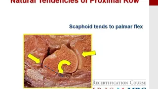 MILLER'S 2016 Orthopaedics:  Hand and Wrist