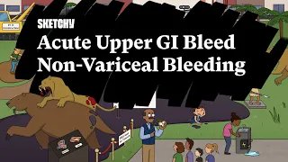 Acute Upper GI Bleed Lesson (Non-Variceal Bleeding)(Full Lesson) | Sketchy Medical | USMLE Step 2 CK