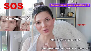 Cosmelan peel treatment questions answered (2023) everything you asked me (Part 1)