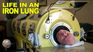 What It's Like to Be In an Iron Lung