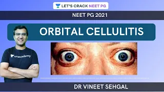 Orbital Cellulitis |  NEET-PG 2021 | Vineet Sehgal