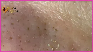Satisfying with Nippers