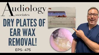 DRY PLATES OF EAR WAX REMOVAL - EP475