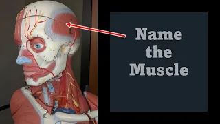 Muscle Practical Exam Practice that's Practically Priceless!