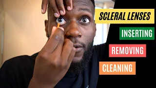 KC Hacks! - Inserting, Removing And Cleaning Scleral Lenses  || Scleral Lenses